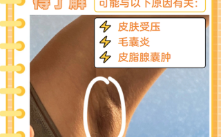 孕期腋下疼肉疙瘩是何原因？