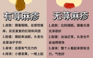 儿童寻麻疹症状和治疗有哪些关键点？家长如何应对才能有效缓解？