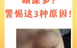 新生儿左眼流泪眼屎怎么办？