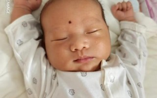 新生儿快满月脸发黄是正常生理现象还是需要就医的信号？