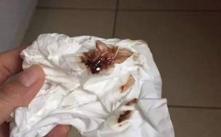 孕期褐色分泌物是正常生理现象还是危险信号？需要警惕哪些异常情况？