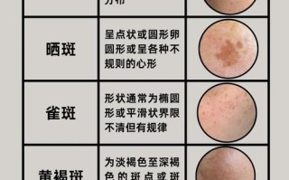 怀孕期间长斑是激素变化导致？还是身体发出的健康预警？