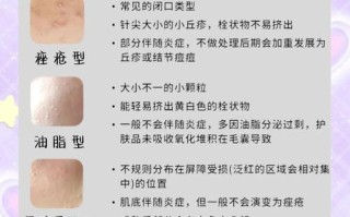孕期长闭口粉刺反反复复，到底该怎么安全护理才能消？