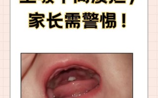 新生儿颚裂究竟是什么原因导致的呢？