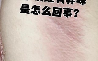 孕期腋下异味是激素变化还是代谢异常？该怎么护理才安心？