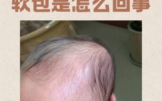 新生儿头上软包是什么原因？如何安全有效消除？需要警惕哪些异常情况？