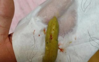 新生儿 大便少量血丝