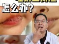 新生儿吐出豆腐渣样物质是消化问题还是疾病信号？