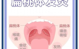 儿童扁桃体发炎，最佳治疗方法是什么？