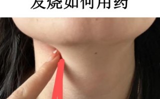 孕期扁桃体发炎青霉素