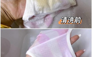 孕期内裤总是黄黄的，是正常生理变化还是健康预警？