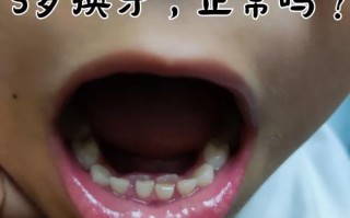 儿童换牙期牙齿不齐，科瓦矫正真的适合吗？