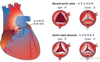 儿童心脏瓣膜关闭不全会影响生长发育吗？该如何治疗和护理？