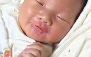 新生儿黄疸一个月未退怎么办？