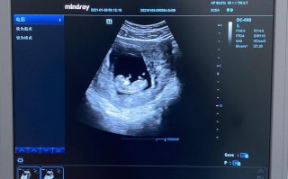 孕期十一周胎儿有多大？此时发育情况与孕周是否匹配？