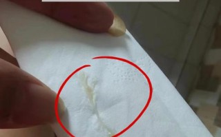 怀孕期间下面出现豆腐渣状分泌物是感染了吗？对胎儿有影响吗？