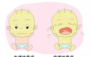 新生儿黄疸眼睛发黄图片能判断病情严重程度吗？