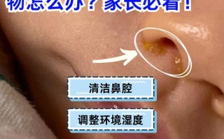 新生儿鼻腔为何总是鼻屎堆积？是生理结构特殊还是护理不当导致的？