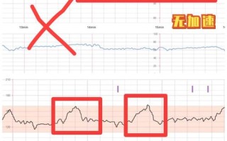 孕期胎心监护到底要做几次？不同孕周频率有何差异？