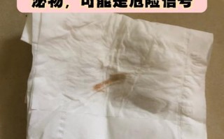 怀孕期间白带呈咖啡色是正常现象还是异常信号？