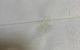 儿童喉咙有痰粘着不出，该怎么办？