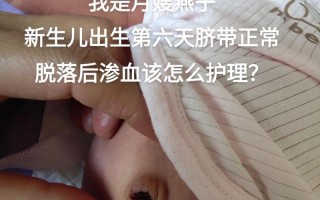 新生儿肚脐脱落后出血怎么办？