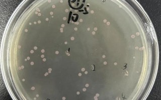 新生儿人葡萄球菌亚种