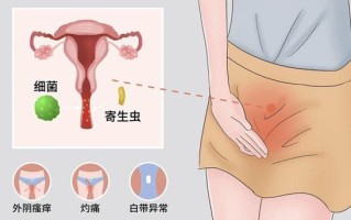 孕期下身瘙痒是正常现象吗？需要警惕哪些潜在问题？