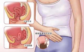 孕期外阴肿大怎么办？这5种缓解方法准妈妈必看！