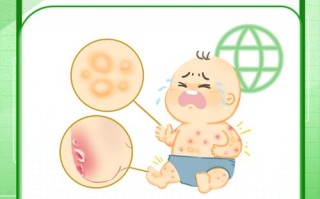 儿童身上起水泡是怎么回事