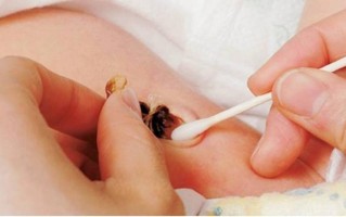 脐带脱落前能洗澡吗？