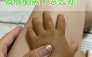 新生儿晒太阳会变黑吗？科学解答肤色变化与正确晒太阳方法