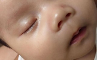 新生儿眼红血丝正常吗？