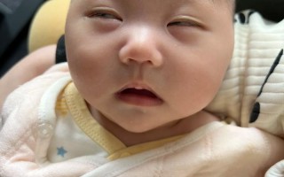 新生儿睡觉时翻白眼是正常现象还是健康预警？