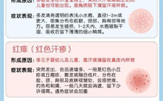 新生儿着凉有哪些症状