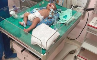 早产儿肺部感染高发，如何精准防治与降低远期风险？