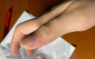 孕期阴唇瘙痒能用盐水清洗吗？这样处理会加重症状还是有助缓解？