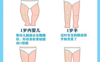 新生儿婴儿正常腿型图包含哪些阶段？不同月龄腿型标准是什么？