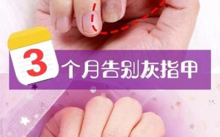 怀孕期间得了灰指甲怎么办？安全有效的治疗方法有哪些？