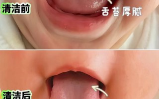 新生儿喝奶粉后舌头发白是正常现象还是健康问题？