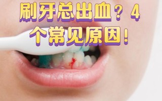 孕期刷牙总出血，是身体缺信号吗？