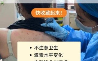 孕期背上痘痘频发，是激素波动还是皮肤代谢异常在作祟？