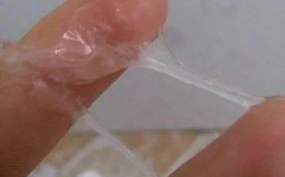 孕期下面流白色分泌物是正常现象还是异常信号？需要警惕哪些问题？