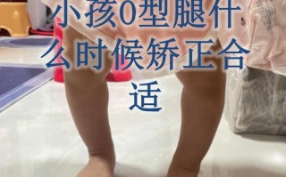 新生儿罗圈腿是正常现象还是需要干预？如何判断及有效纠正？