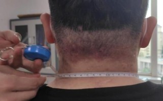 怀孕黑色分泌物正常吗？