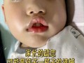 新生儿醒着总张嘴是正常现象还是健康预警？需关注哪些潜在问题？