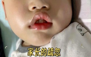 新生儿醒着总张嘴是正常现象还是健康预警？需关注哪些潜在问题？