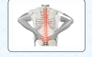 儿童强直性脊柱炎症状