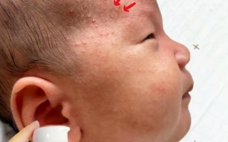 新生儿皮肤娇嫩，能用儿童霜吗？会不会有刺激或过敏风险？