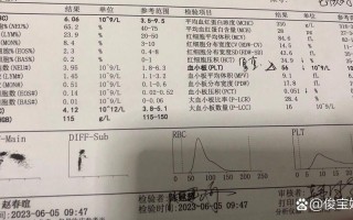 孕期血小板分布宽度偏低对胎儿发育有影响吗？需要干预治疗吗？